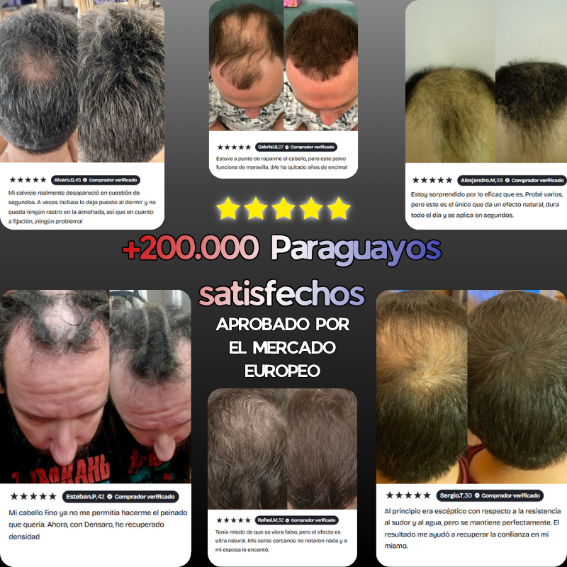 Oculta tu calvicie con