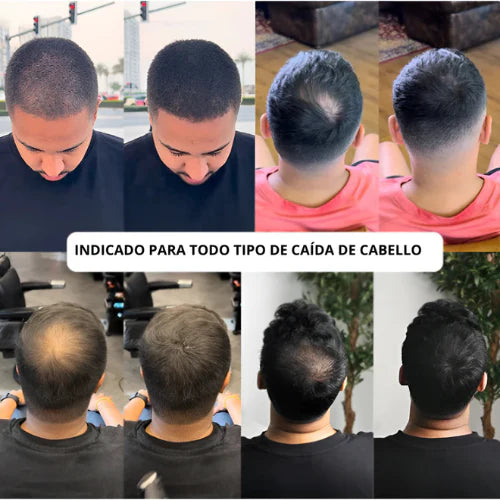 Eternal For Hair – Camuflaje Capilar 🇵🇾