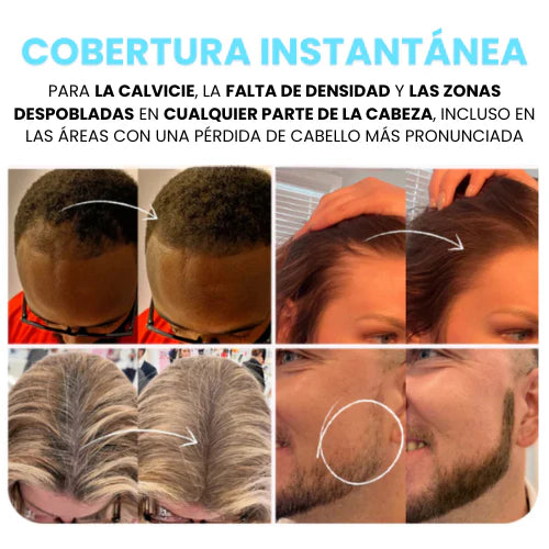 Eternal For Hair – Camuflaje Capilar