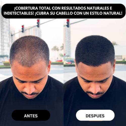 Eternal For Hair – Camuflaje Capilar