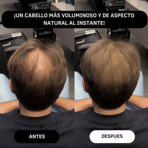 Eternal For Hair – Camuflaje Capilar