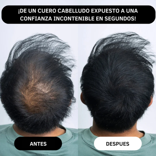 Eternal For Hair – Camuflaje Capilar