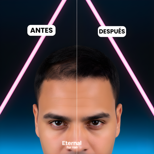 Eternal For Hair – Camuflaje Capilar 🥇