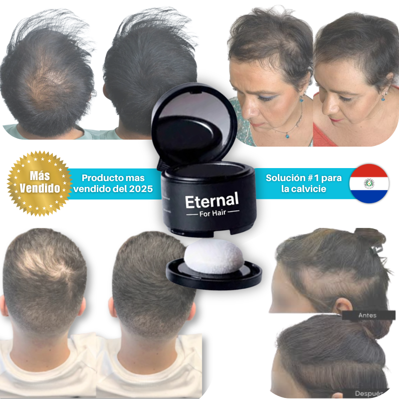 Oculta tu calvicie con