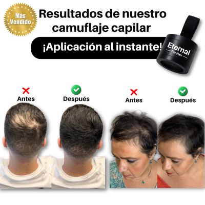 Cobertor Capilar - ¡Para mujeres y hombres!