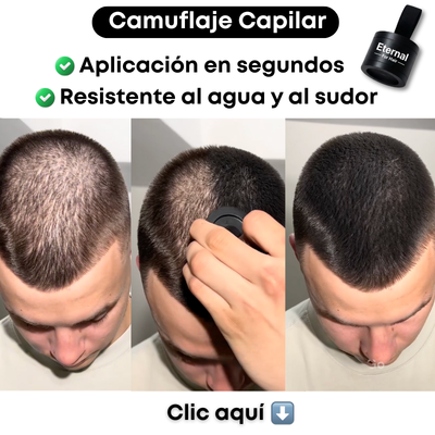 Cobertor Capilar - ¡Para mujeres y hombres!